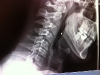 neck