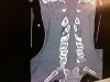 neck1