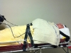 stretcher