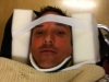 stretcher3