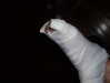 leg_splint3